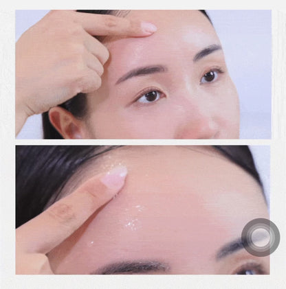 Care Plus Scar Cover Sivilce Bandı (368 Adet)